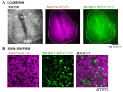 視交叉上核の「時計遺伝子」と「細胞内カルシウム」のリズムを観察