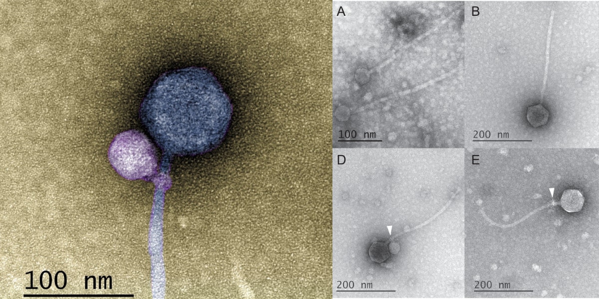 史上初の快挙！ウイルスが別のウイルスに合体する様子を発見！