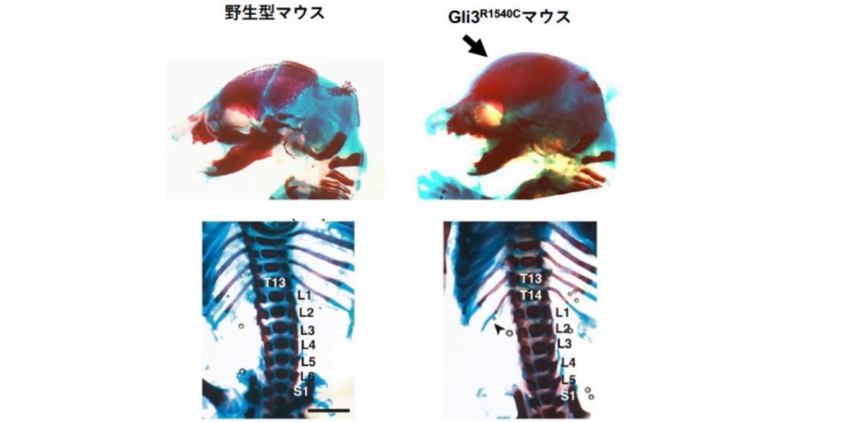 ネアンデルタール由来のタンパク質で骨格が変化！