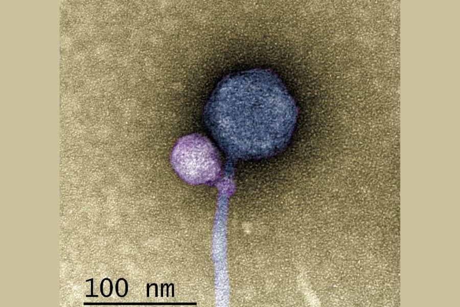 驚異の発見！別のウイルスに寄生するウイルスの姿を撮影！
