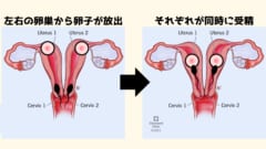 2つの子宮を持つ女性が両方で妊娠していたと判明！