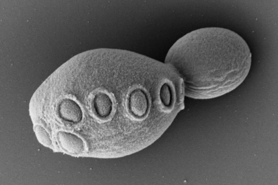 50%以上が「人工合成DNA」で作られた酵母の作成に成功！