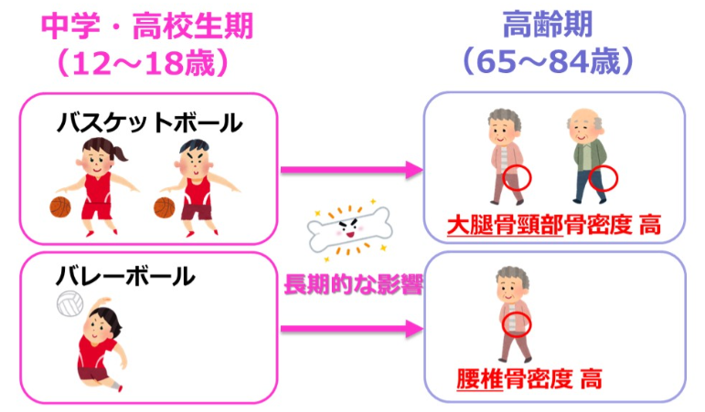 バスケとバレーは高齢期の骨密度を高く維持する