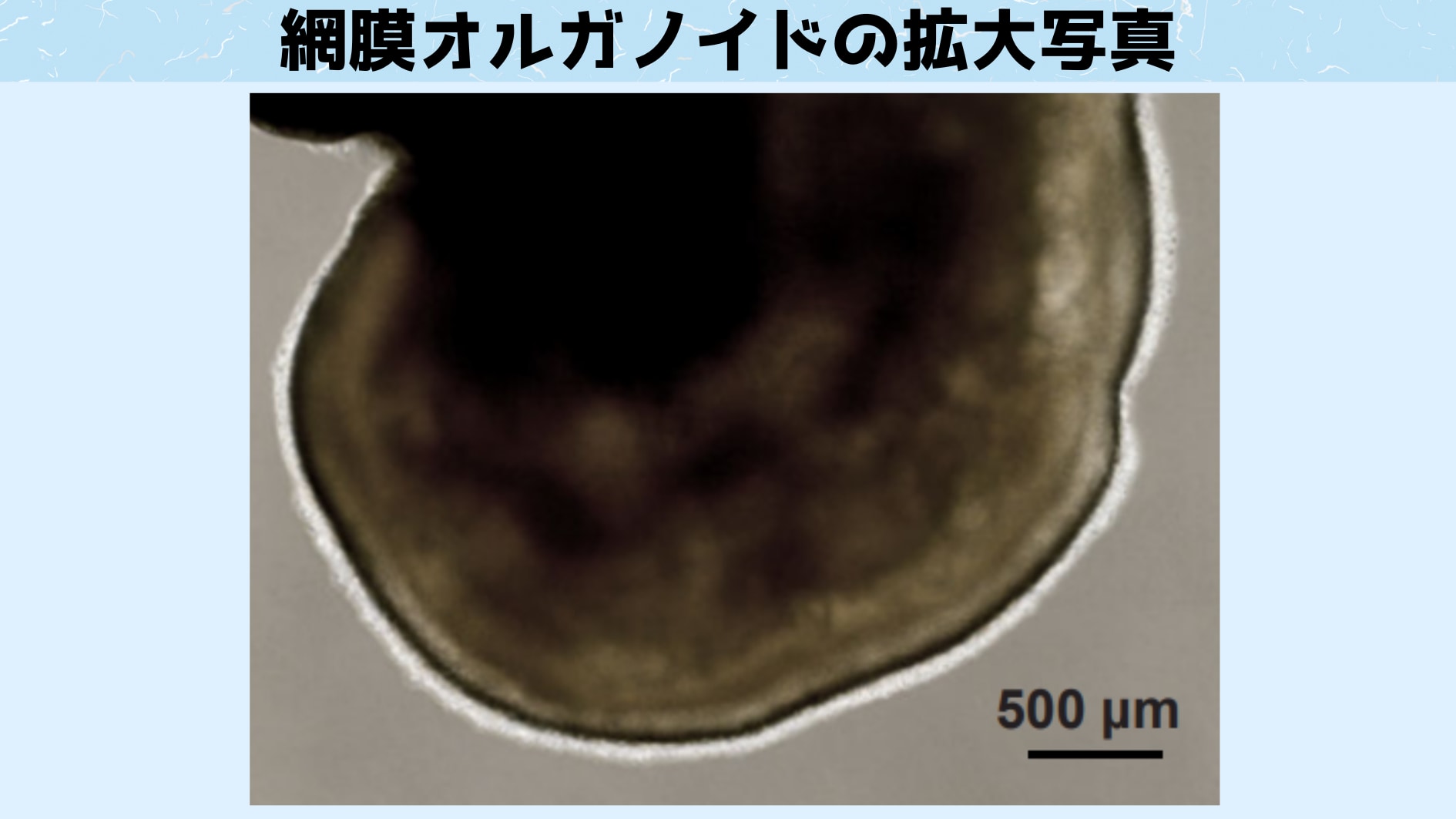 「私の赤」と「あなたの赤」は違う可能性が高い　色覚細胞の研究から意外な発見