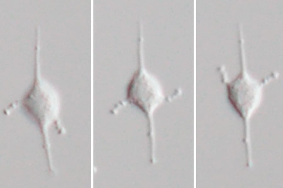 腕振りで泳ぐ姿が可愛らしい謎多き単細胞の原生生物「メテオラ」とは？