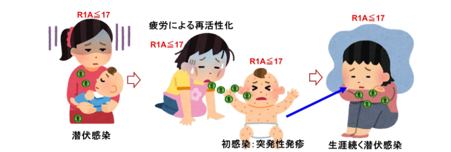 HHV-6を介したうつ遺伝のシナリオ。新生児期にHHV-6に初感染すると「突発性発疹」が見られる。（※図中のR1A≦17がうつを起こしやすいHHV-6を指す）