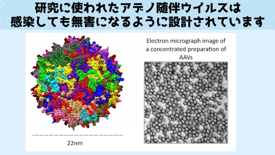 難聴の少年を遺伝子治療して音を聞こえるようにすることに成功！