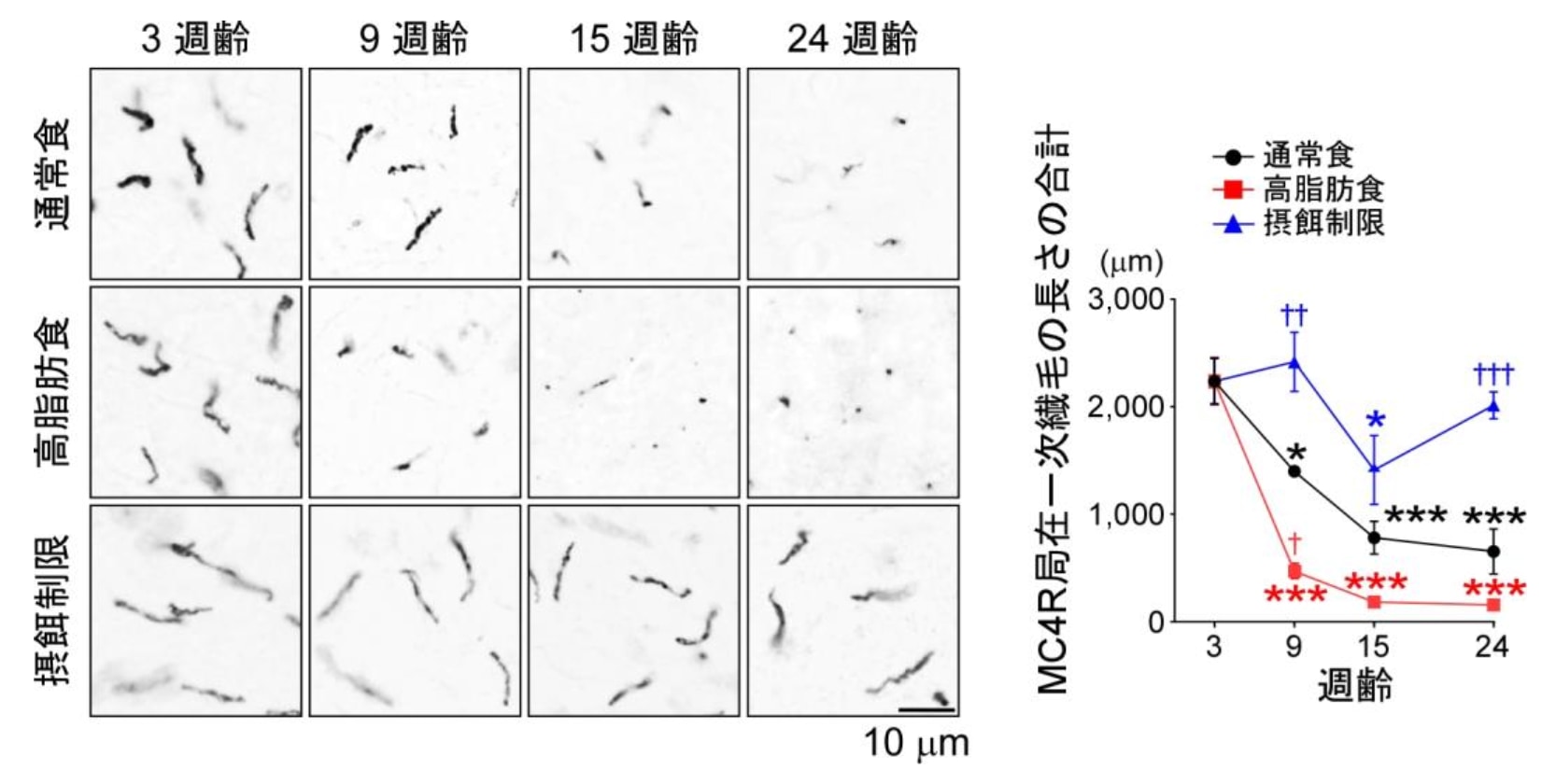 MC4Rが局在する一次繊毛は加齢に伴い短くなっていた。加えて高脂肪食で退縮スピードが上がっていた