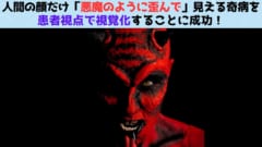 人間の顔だけ「悪魔のように歪んで」見える奇病を患者視点で視覚化することに成功！