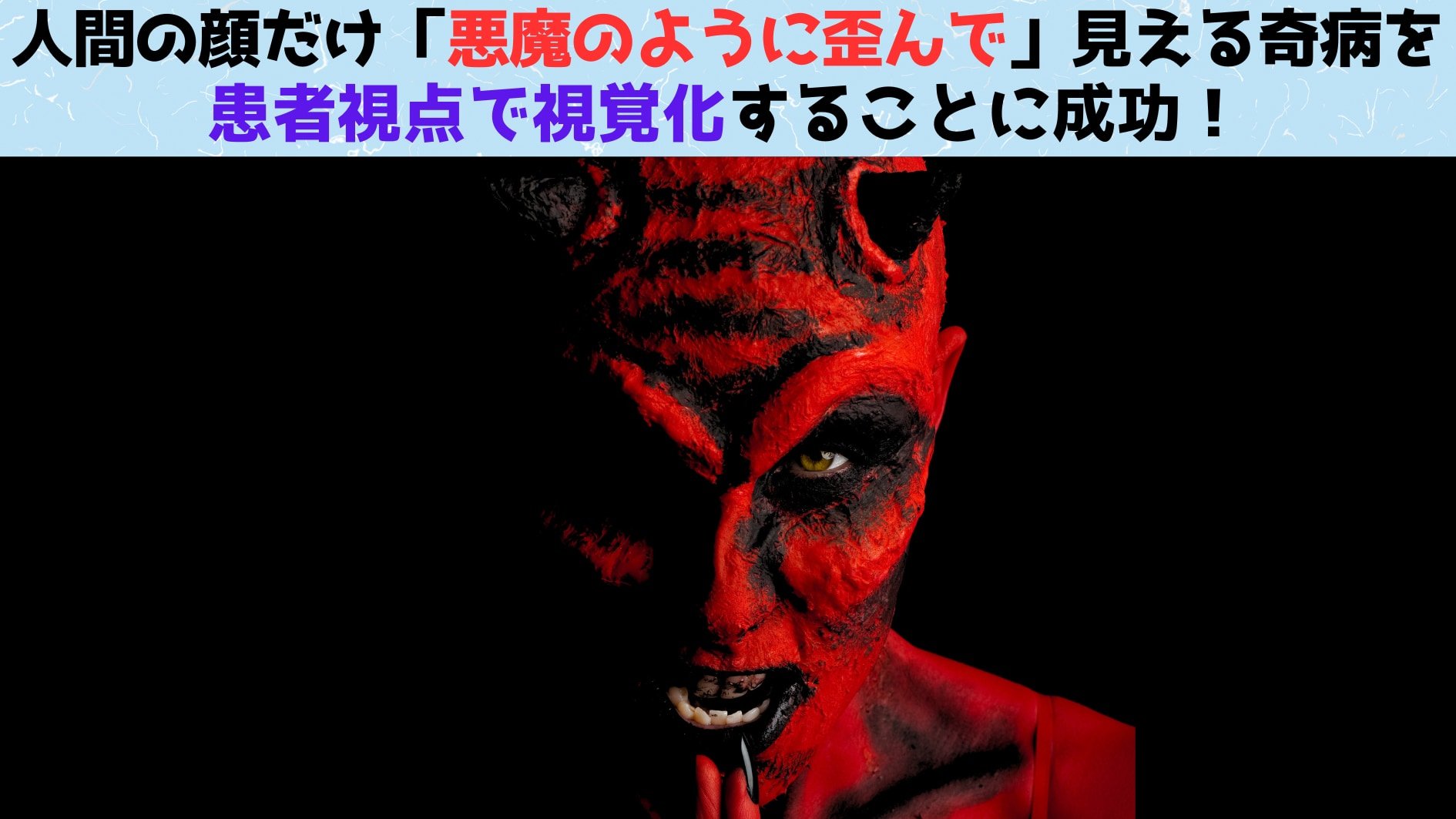 人間の顔だけ「悪魔のように歪んで」見える奇病を患者視点で視覚化することに成功！