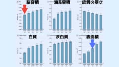 うまれた年代ごとに脳の大きさ