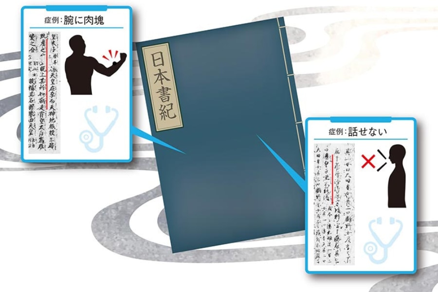 「尻尾の生えた人がいた」日本書紀の奇妙な記述は”古代の先天異常”を記している