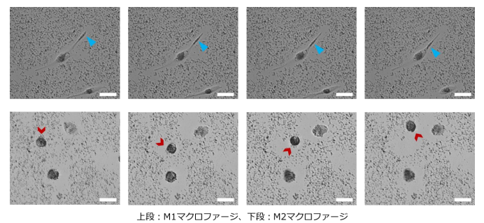 M1型とM2型のマクロファージが周囲の結晶を溶かす様子