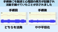 心拍数も脳波も弱っているが検出された