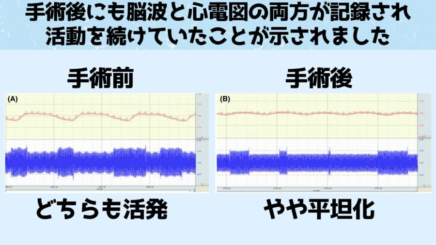 心拍数も脳波も弱っているが検出された