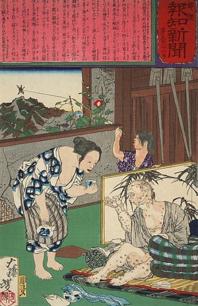 ハンセン病の夫を看病する妻（画・月岡芳年、1875年）