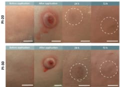 2匹のブタの皮膚：左から採血前と採血直後、24〜72時間後の傷口