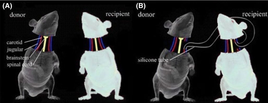 ネズミの頭を別のネズミの体に移植する研究のまとめ「頭部移植の歴史」