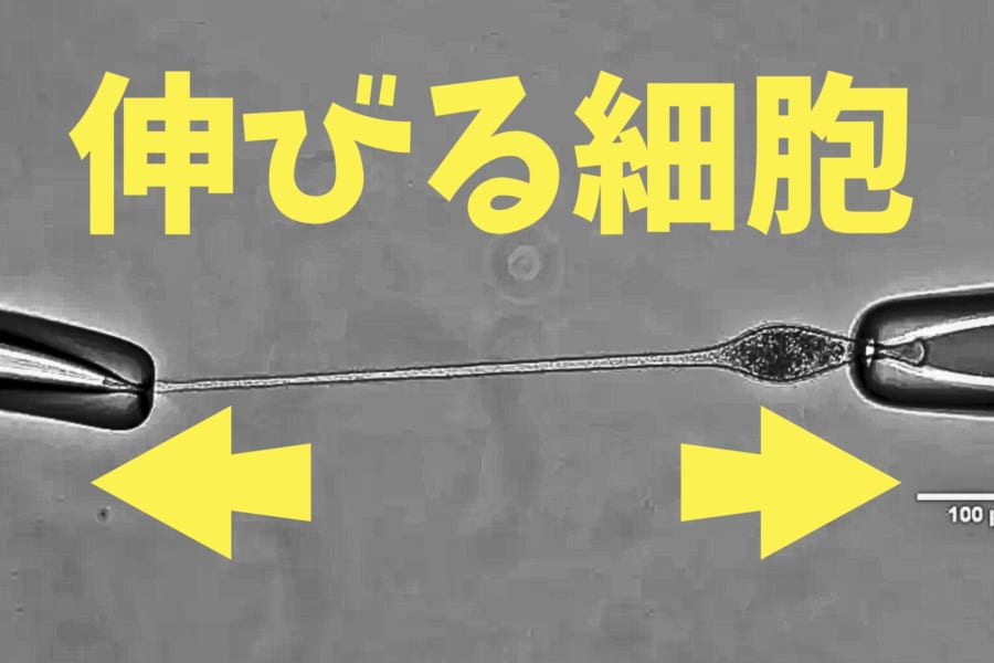 30倍も体が伸びる単細胞生物「ラクリマリア」の謎！研究者「細胞膜はそんな伸びない…」