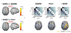 左：マルチタスクで活動が増加した脳領域、右：情報伝達もマルチタスクでのみ増加