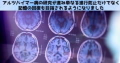 抗がん剤にアルツハイマー病で「失われた記憶」を蘇らせる効果を発見！