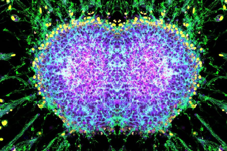 「芸術と科学が出会うとき」美しい顕微鏡画像コンテスト