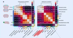 脳の再生医療に光、脳細胞を脳幹細胞に再プログラムすることに成功！の画像 3/5