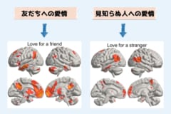 「恋愛と家族愛の違い」脳は相手によって愛情を感じる場所が違っていたの画像 4/5