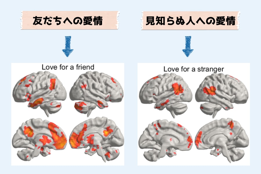 「恋愛と家族愛の違い」脳は相手によって愛情を感じる場所が違っていたの画像 4/5