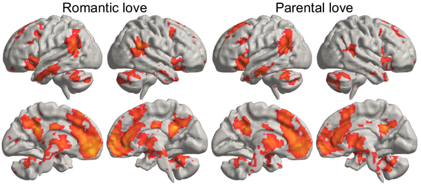 「恋愛と家族愛の違い」脳は相手によって愛情を感じる場所が違っていたの画像 3/5
