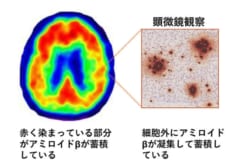 カフェインを控えすぎると記憶障害になるリスクが「3倍」近く増加すると判明の画像 3/3