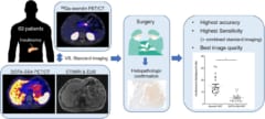 新技術エクセンディンPET/CTと従来の技術DOTA-SSA PET/CT、CE-DWI-MRI、CECT、EUSを比較