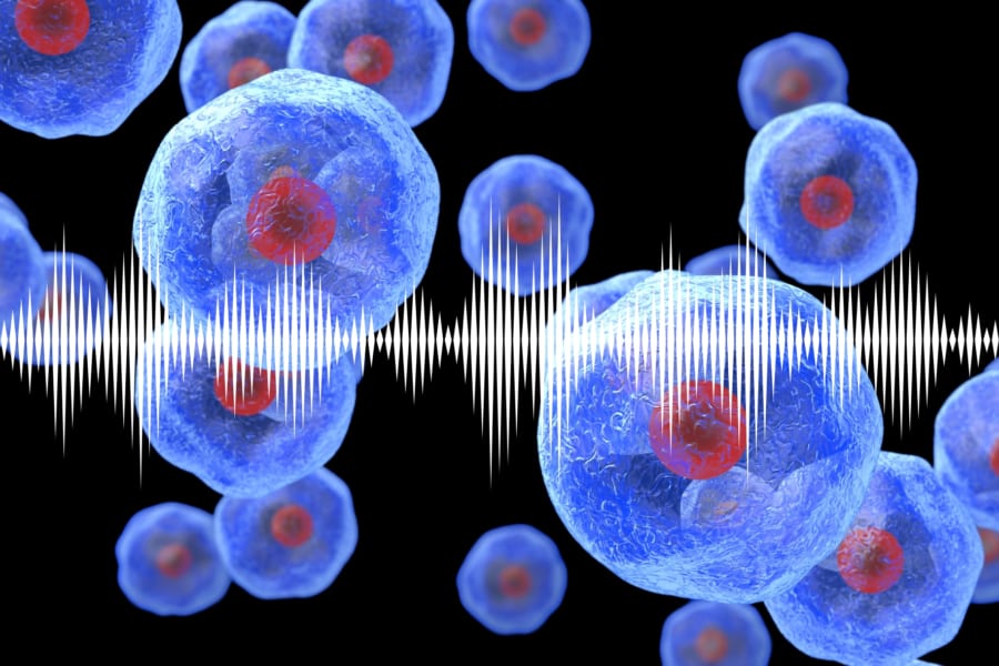 ヒト細胞の「共鳴周波数」を特定することに成功！――利用すれば細胞破砕も可能
