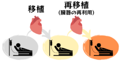 移植された臓器を「別の人へ再び移植」できるのか？の画像 1/4