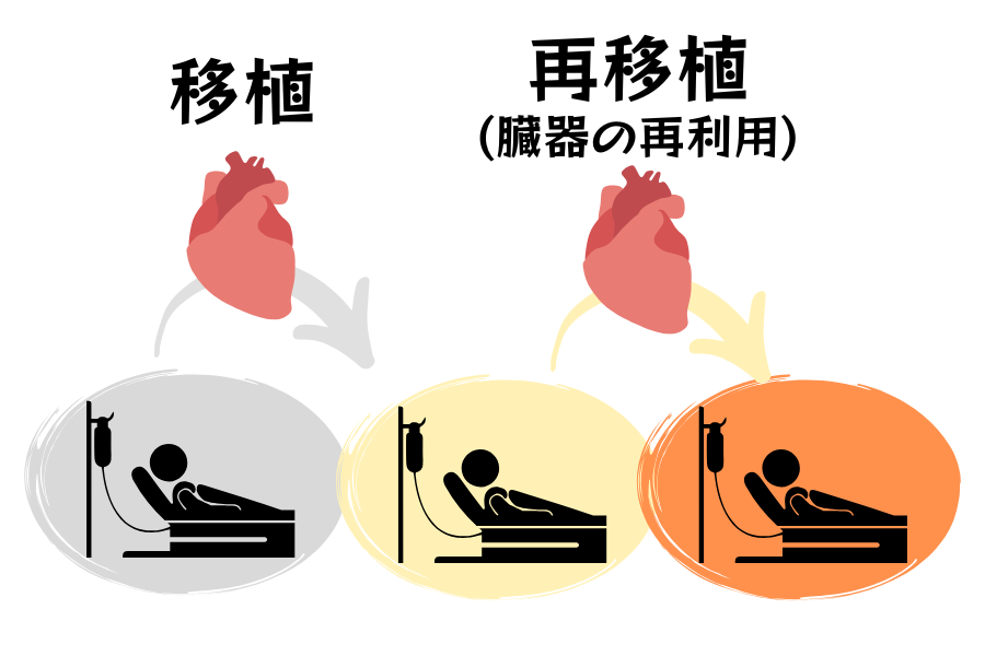 移植された臓器を「別の人へ再び移植」できるのか？の画像 4/4