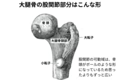 大腿骨は股関節にすっぽりはまり込んだボールのような形