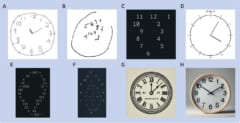 古いAIが認知症と診断されてしまう？医学テストで明らかになった驚愕の事実の画像 3/4