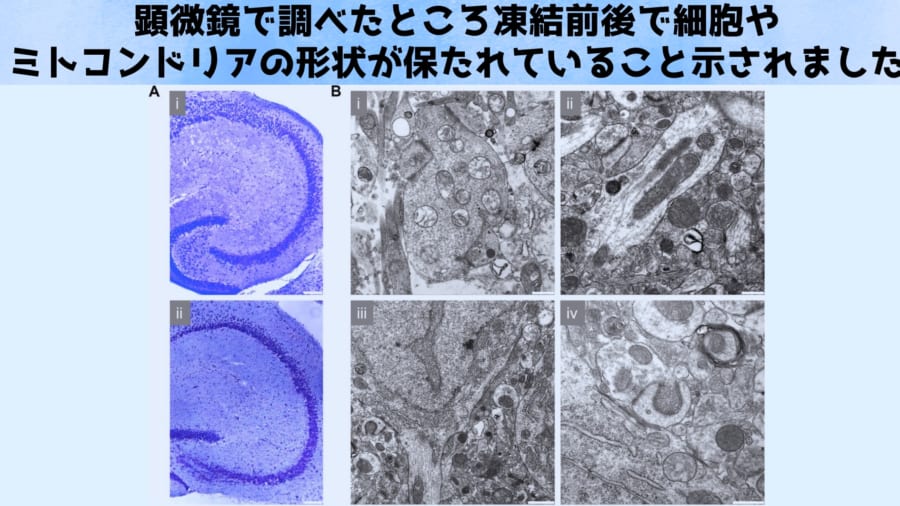 脳の一部を凍らせて1週間後に蘇生することに成功！