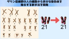 ダウン症候群の人の細胞から余分な染色体を除去する新手法を開発