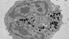 献血をする人は遺伝子レベルで「血液が健康に変化」していたの画像 3/3