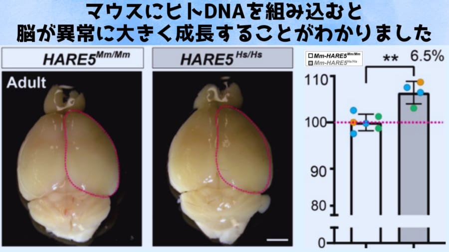 マウスにヒトDNAを組み込むと異常に巨大な脳が成長 - ナゾロジー