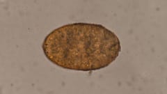 「ヒトの細胞の皮を被ったバケモノ」の真実