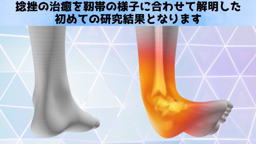 痛み消失=完治?その思い込みが再発を呼ぶ