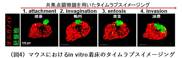 着床の4段階をリアルタイムで観察できました