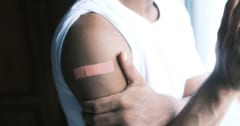 ヒトの皮膚は他の哺乳類に比べて「傷の治りが3倍遅い」と判明！の画像 1/3
