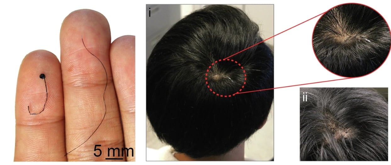 脳波検査の常識を覆す「髪の毛」みたいな極細電極が開発されるの画像 3/4