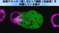 人間の細胞を殺しその膜をまとって偽装する侵略的寄生虫の画像 2/4