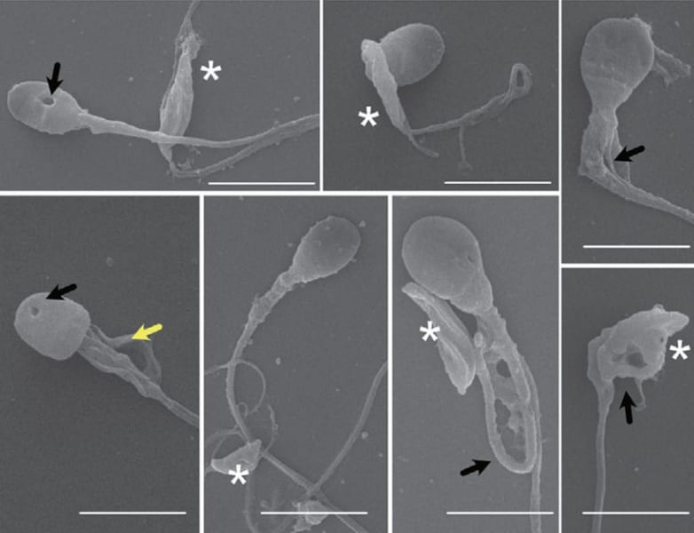 猫の寄生虫は5分で人間の精子の頭を切断できる