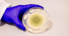 古代の墓から蘇った「死のカビ」を「抗がん薬」に変えることに成功！の画像 1/3