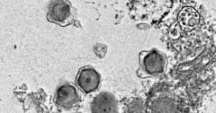 世界各地の海から「未知の巨大ウイルス」230種類を発見の画像 1/3